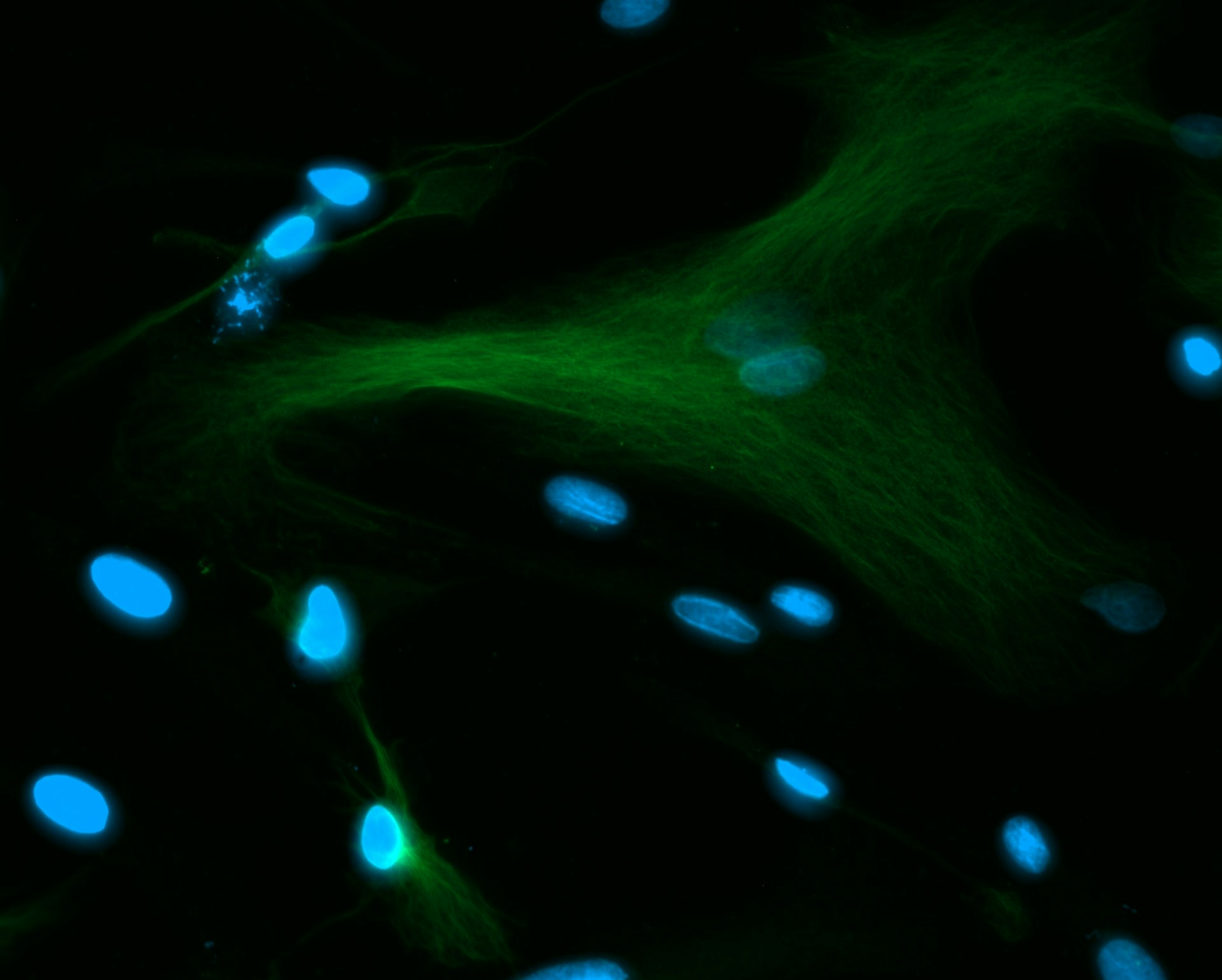 Fluorescence micrograph, narrow field: green cytoskeletal filaments crossing between scattered blue-stained nuclei on black